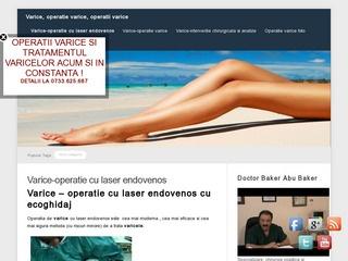 Clinica Estet Laser - tratare varice